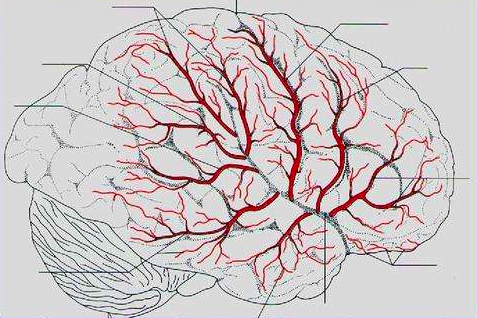 中国脑血管疾病分类